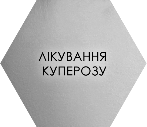 Лікування куперозу