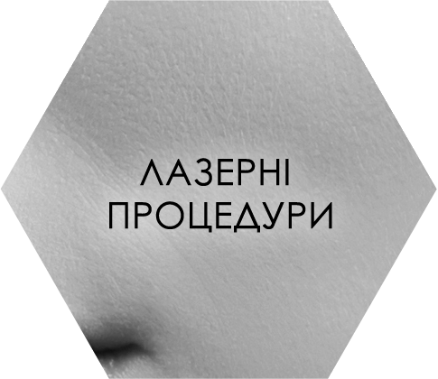 Лазерні процедури